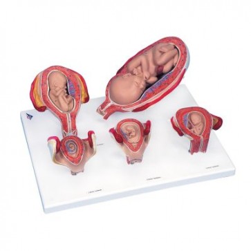 Serija anatomskih modela različitih stadija trudnoće